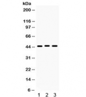 Western blot testing of 1) rat stomach, 2) human HeLa and 3) human PANC lysate with Connexin 45 antibody. Expected/observed molecular weight ~45 kDa.