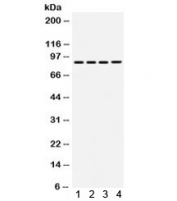 Western blot testing of human 1) MCF7, 2) SW620, 3) 22RV1 and 4) HeLa cell lysate with TGF beta Receptor II antibody. Expected molecular weight ~65 kDa, routinely observed at 65-80 kDa.