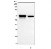 Western blot testing of human 1) MCF7, 2) SW620, 3) 22RV1 and 4) HeLa cell lysate with TGF beta Receptor II antibody. Expected molecular weight ~65 kDa, routinely observed at 65-80 kDa.