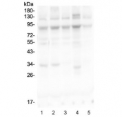 Western blot testing of human 1) HEK293, 2) HeLa, 3) COLO320, 4) T-47D and 5) A549 cell lysate with MLH1 antibody. Predicted molecular weight: 85/58/74 kDa (isoforms 1/2/3).