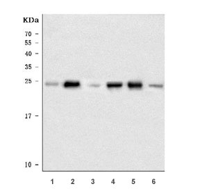 Western blot testing of 1) rat kidney, 2) rat NRK, 3) rat PC-12, 4) mouse kidney, 5) mouse HBZY and 6) mouse RAW264.7 cell lysate with Aquaporin 2 antibody. Observed molecular weight: 29-46 kDa depending on glycosylation level.
