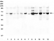 Western blot testing of 1) rat brain, 2) rat ovary, 3) mouse brain, 4) mouse testis, 5) mouse ovary, 6) mouse NIH3T3, 7) human placenta, 8) human HEK293, 9) monkey COS-7, 10) human PC-3, 11) human 22RV1 and 12) human K562 lysate with SLC19A1 antibody. Predicted molecular weight ~65 kDa.