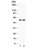 Western blot testing of 1) rat brain and 2) human U87 lysate with 5HT2B Receptor antibody. Predicted/observed molecular weight ~54 kDa.