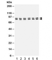 Western blot testing of rat 1) testis, 2) brain, 3) liver,  and human 4) placenta, 5) MCF7, and 6) SW620 lysate with STAT1 antibody. Predicted/observed molecular weight: ~91/84 kDa (alpha/beta).