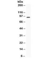 Western blot testing of rat brain with STAT6 antibody. Predicted/observed molecular weight ~94 kDa.