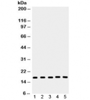 Western blot testing of 1) rat lung, 2) mouse liver, 3) human A549, 4) PANC and 5) 293 lysate with Caspase-2 antibody. Predicted molecular weight: ~47 kDa (full), ~31 kDa (large+small subunit), ~11 kDa (small subunit).