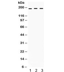 Western blot testing of human 1) SW620, 2) COLO320 and 3) HepG2 cell lysate with LIFR antibody. Expected/observed molecular weight ~124/190 kDa (unmodified/glycosylated).