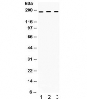 Western blot testing of human 1) SW620, 2) COLO320 and 3) HepG2 cell lysate with LIFR antibody. Expected/observed molecular weight ~124/190 kDa (unmodified/glycosylated).