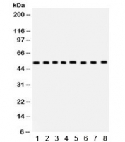 Western blot testing of 1) rat liver, 2) human placenta, 3) rat spleen, 4) rat pancreas, 5) human HepG2, 6) HeLa, 7) HEPA and 8) 22RV1 lysate with WASP antibody. Expected/observed molecular weight ~53 kDa.