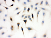 ICC testing of A549 cells with WASP antibody.