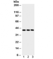 Western blot testing of human 1) placenta, 2) A549 and 3) HepG2 lysate with PTGER2 antibody. Expected/observed molecular weight: 40~53 kDa depending on glycosylation level.