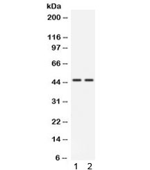 Western blot testing of human 1) HeLa and 2) 22RV1 cell lysate with CTSK antibody. Predicted molecular weight ~37 kDa, with an ~46 kDa pro form and an ~27 kDa mature form.~