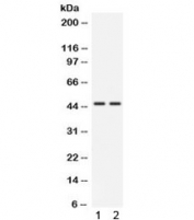 Western blot testing of human 1) HeLa and 2) 22RV1 cell lysate with CTSK antibody. Predicted molecular weight ~37 kDa, with an ~46 kDa pro form and an ~27 kDa mature form.