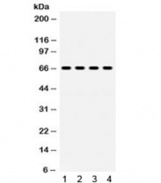 Western blot testing of 1) rat lung, human 2) HeLa, 3) K562 and 4) Jurkat lysate with GRK6 antibody. Expected/observed molecular weight ~66 kDa.
