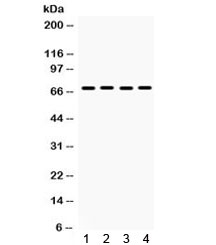 Western blot testing of 1) rat lung, human 2) HeLa, 3) A549 and 4) SW620 lysate with ETV4 antibody. Expected/observed molecular weight ~68 kDa.