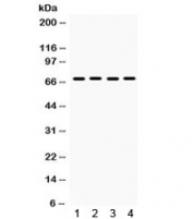Western blot testing of 1) rat lung, human 2) HeLa, 3) A549 and 4) SW620 lysate with ETV4 antibody. Expected molecular weight: 54-61 kDa.