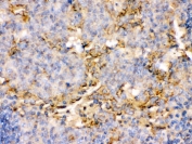 IHC testing of FFPE human tonsil with OX40 antibody. HIER: Boil the paraffin sections in pH 6, 10mM citrate buffer for 20 minutes and allow to cool prior to staining.