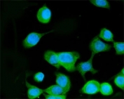 Immunofluorescent staining of FFPE human Caco-2 cells with MKK3 antibody (green) and DAPI nuclear stain (blue). HIER: steam section in pH6 citrate buffer for 20 min.