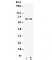 Western blot testing of 1) human HeLa and 2) mouse NIH3T3 cell lysate with Phospholipase A2 antibody. Expected/observed molecular weight ~85 kDa.