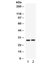 Western blot testing of 1) rat kidney and 2) mouse kidney lysate with IGFBP1 antibody. Predicted/observed molecular weight ~28 kDa.