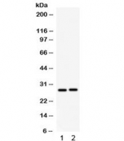 Western blot testing of 1) rat kidney and 2) mouse kidney lysate with IGFBP1 antibody. Expected molecular weight: 28-35 kDa.