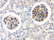 IHC testing of FFPE rat kidney with Nestin antibody. HIER: Boil the paraffin sections in pH 6, 10mM citrate buffer for 20 minutes and allow to cool prior to staining.