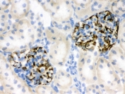 IHC testing of frozen rat kidney tissue with Nestin antibody.