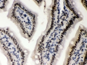 IHC testing of FFPE mouse intestine with CSNK1A1 antibody. HIER: Boil the paraffin sections in pH 6, 10mM citrate buffer for 20 minutes and allow to cool prior to staining.