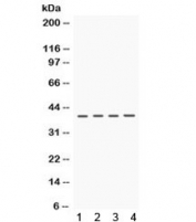 Western blot testing of 1) rat brain, 2) rat kidney, 3) mouse kidney and 4) human HeLa lysate with CSNK1A1 antibody.  Expected/observed molecular weight ~39 kDa.