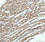 IHC staining of FFPE rat heart tissue with IDH2 antibody. HIER: boil tissue sections in pH8 EDTA for 20 min and allow to cool before testing.