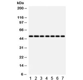 Western blot testing of 1) rat heart, 2) rat liver, 3) mouse NIH3T3, 4) human SW620, 5) HeLa, 6) MCF7 and 7) 22RV1 lysate with IDH2 antibody. Predicted/observed molecular weight ~51 kDa.