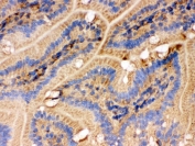 IHC testing of frozen mouse small intestine tissue with IDH2 antibody.