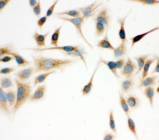 ICC staining of FFPE human A549 cells with IDH2 antibody at 1ug/ml. HIER: boil tissue sections in pH6, 10mM citrate buffer, for 10-20 min and allow to cool before testing.