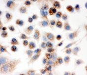 ICC staining of FFPE mouse Hepa 1-6 cells with IDH2 antibody at 1ug/ml. HIER: boil tissue sections in pH6, 10mM citrate buffer, for 10-20 min and allow to cool before testing.