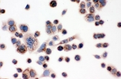 ICC staining of FFPE human SW480 cells with IDH2 antibody at 1ug/ml. HIER: boil tissue sections in pH6, 10mM citrate buffer, for 10-20 min and allow to cool before testing.