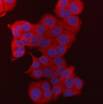 Immunofluorescent staining of FFPE human T47-D cells tissue with FASN antibody (red) and DAPI nuclear stain (blue). HIER: steam section in pH6 citrate buffer for 20 min.