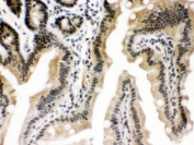 IHC testing of FFPE mouse intestine with CTCF antibody. HIER: Boil the paraffin sections in pH 6, 10mM citrate buffer for 20 minutes and allow to cool prior to staining.