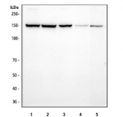 Western blot testing of 1) human MCF7, 2) human SiHa, 3) human HepG2, 4) rat brain and 5) mouse brain tissue lysate with CTCF antibody. Predicted molecular weight: 70/82/130 kDa (referred to as CTCF-70, -82 and -130).