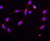 Immunofluorescent staining of FFPE human U-2 OS cells with CTCF antibody (red) and DAPI nuclear stain (blue). HIER: steam section in pH6 citrate buffer for 20 min.