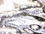 IHC testing of FFPE rat intestine with CTCF antibody. HIER: Boil the paraffin sections in pH 6, 10mM citrate buffer for 20 minutes and allow to cool prior to staining.