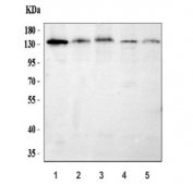 Western blot testing of 1) human 293T, 2) human Caco-2, 3) rat C6, 4) mouse brain and 5) mouse RAW264.7 cell lysate with CTCF antibody. Observed molecular weight: 70/82/130 kDa (referred to as CTCF-70, -82 and -130).