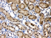 IHC testing of FFPE rat kidney with HINT1 antibody. HIER: Boil the paraffin sections in pH 6, 10mM citrate buffer for 20 minutes and allow to cool prior to staining.