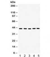 Western blot testing of 1) rat ovary, 2) rat testis, 3) mouse testis, 4) human 22RV1 and 5) human SKOV lysate with GNAQ antibody. Expected molecular weight ~42 kDa.