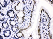 IHC testing of FFPE rat intestine with Cdk9 antibody. HIER: Boil the paraffin sections in pH 6, 10mM citrate buffer for 20 minutes and allow to cool prior to staining.