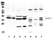 Western blot testing of 1) rat brain, 2) mouse brain, 3) rat liver, 4) mouse liver, 5) human HepG2, 6) human 293T and 7) MCF-7 lysate with PPT1 antibody. Expected/observed molecular weight ~34 kDa.