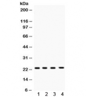 Western blot testing of 1) rat brain, 2) mouse spleen, 3) human HeLa and 4) human MCF7 lysate with RAB7 antibody. Expected molecular weight ~23 kDa.