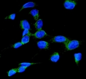 Immunofluorescent staining of FFPE human U-2 OS cells with RAB7 antibody (green) and DAPI nuclear stain (blue). HIER: steam section in pH6 citrate buffer for 20 min.