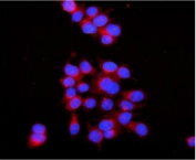Immunofluorescent staining of FFPE human MCF7 cells with RAB7 antibody (red) and DAPI nuclear stain (blue). HIER: steam section in pH6 citrate buffer for 20 min.