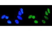 Immunofluorescent staining of FFPE human HeLa cells with RAB9 antibody (green) and DAPI nuclear stain (blue). HIER: steam section in pH6 citrate buffer for 20 min.