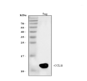 Western blot testing of recombinant mouse CCL11 protein with CCL11 antibody. Expected/observed molecular weight ~11 kDa.